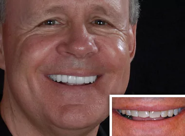 Jerry-Patient of Carlsbad dentist Dr. Kimberly Corrigan-Dankworth