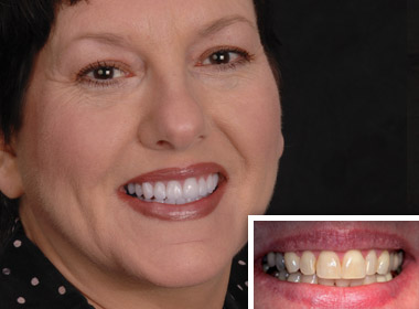 Full mouth reconstruction patient at La Costa Dental Excellence