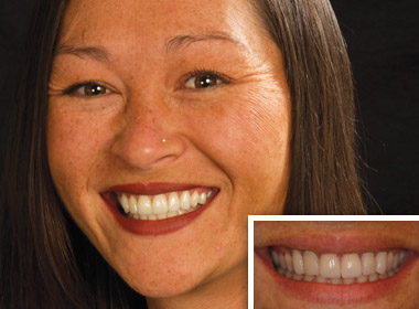 Tiffany-Before and After photos of a sedation dentistry patient of Dr. Dankworth near Encinitas