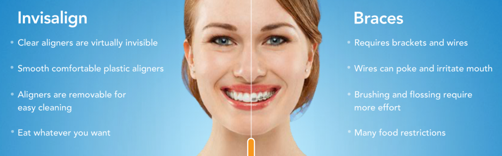 Invisalign vs traditional metal braces is a question many patients throughout Carlsbad, Encinitas, and San Marcos ask.