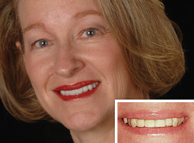 Tooth implants from our dentistry serving Carlsbad and San Marcos