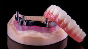 All-on-4 implant supported dentures.